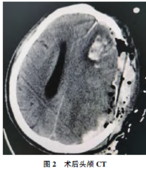 1706052315439859.png 2.png