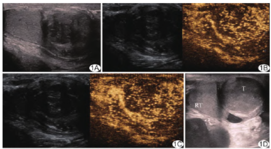 1708471004411084.png 1a-d.png