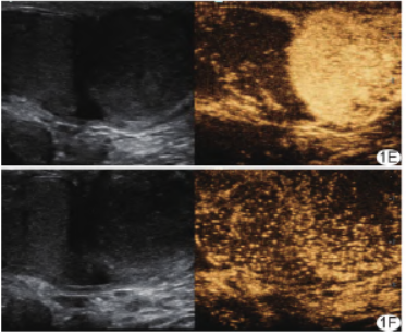 1708471017602797.png 1ef.png