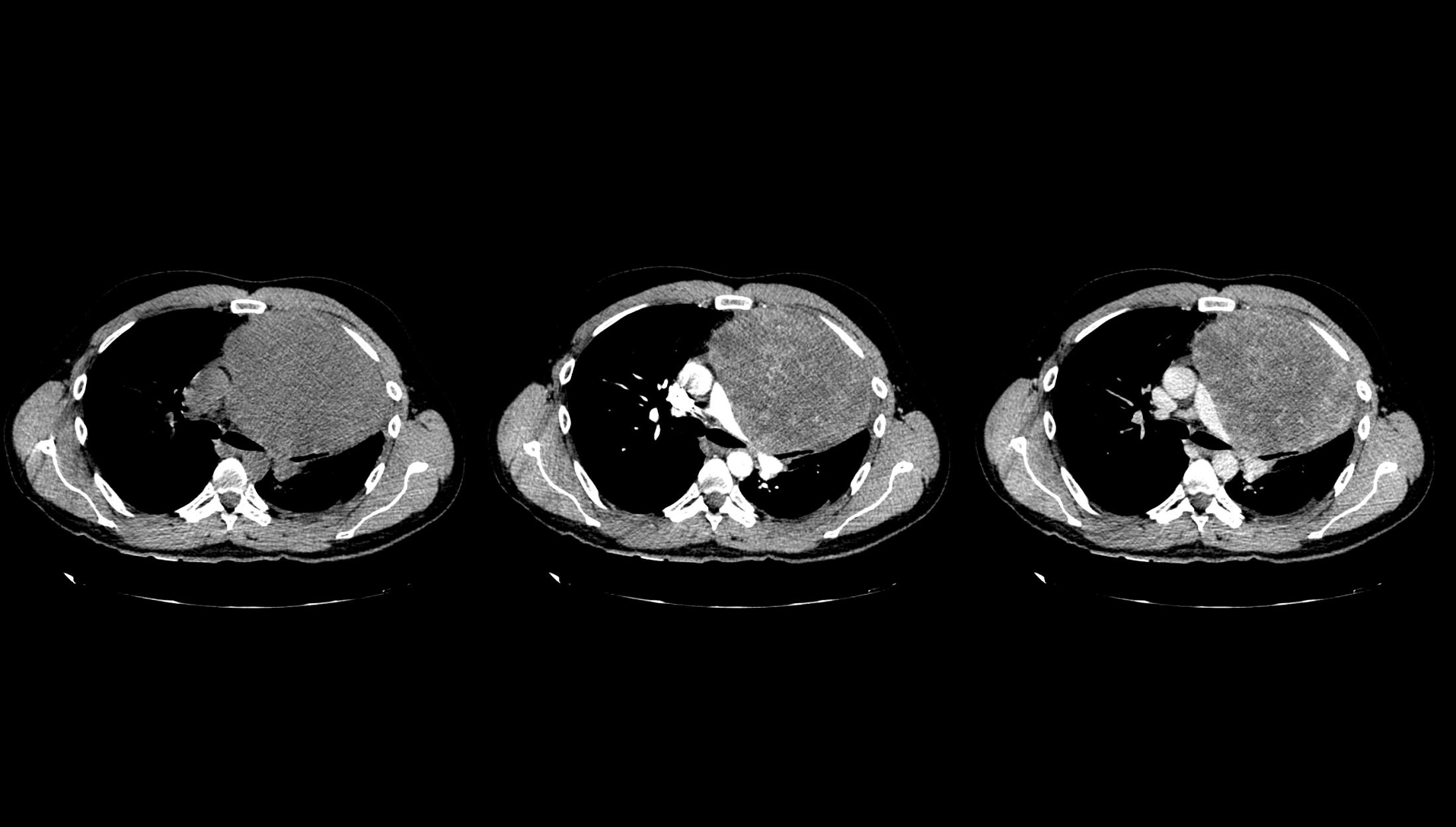 1710075849384690.png 3.png