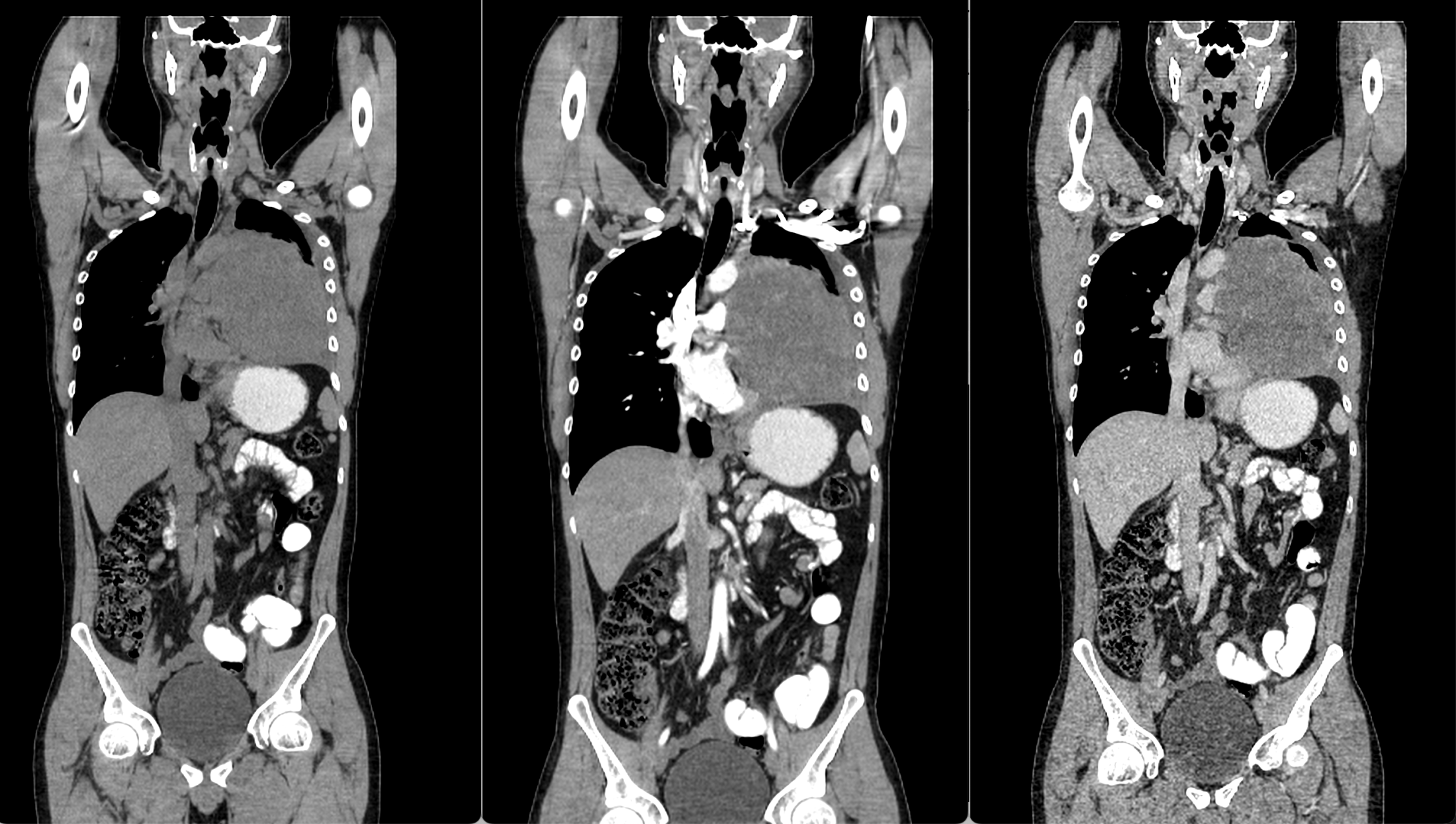 1710075937370858.png 4.png