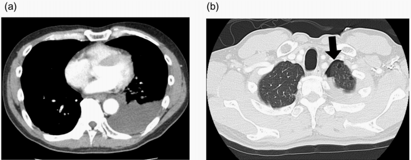 1713262770194625.png 图1.png