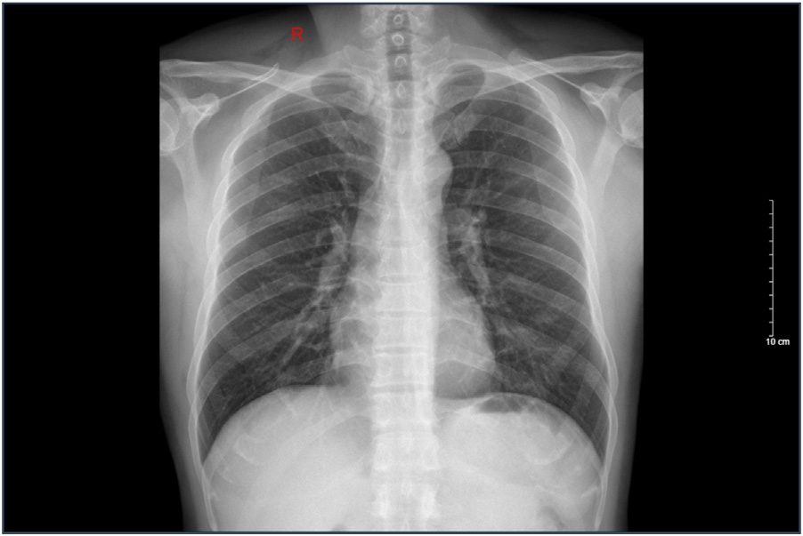 1716110277711492.png 图1.png