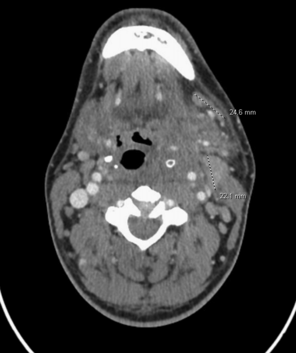 1718192339303907.png 图1.png