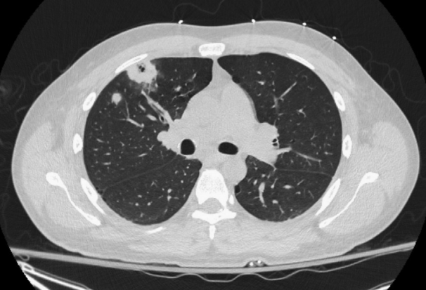 1718192355471786.png 图2.png