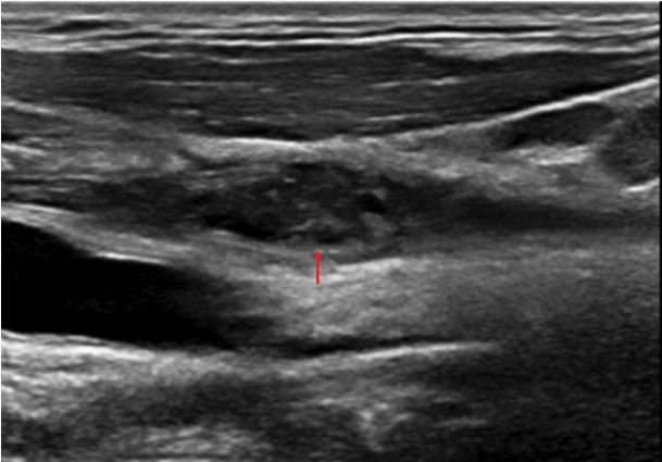 1718192403509533.png 图4.png