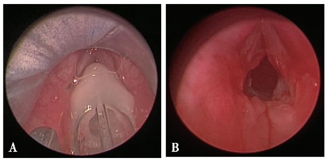 1721364219284417.png 1721364219284417.png