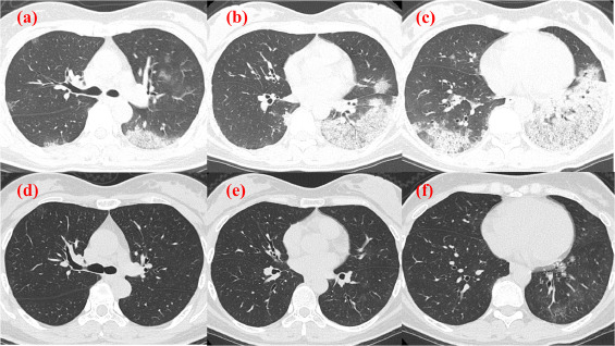 1721814655869880.png 图1.png