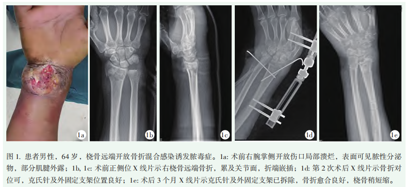 图1.png