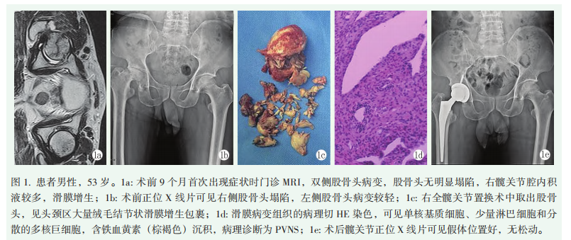 图1.png