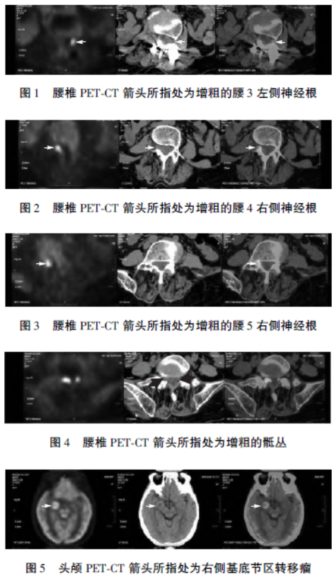 讨论前.png