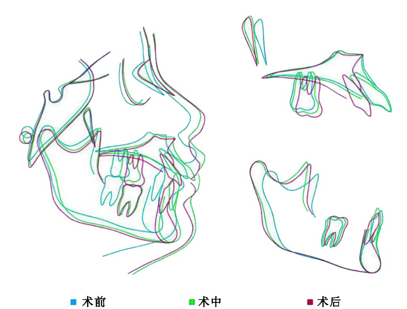 1736919339775132.png