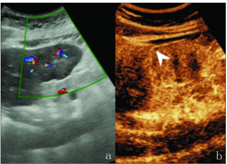 1737869244872417.png 1737869244872417.png