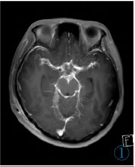 1737943411618699.png 1737943411618699.png