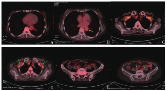 1737953441377633.png 3.png