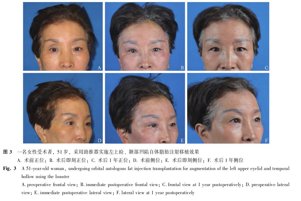 1740101327432923.jpg 1740101327432923.jpg