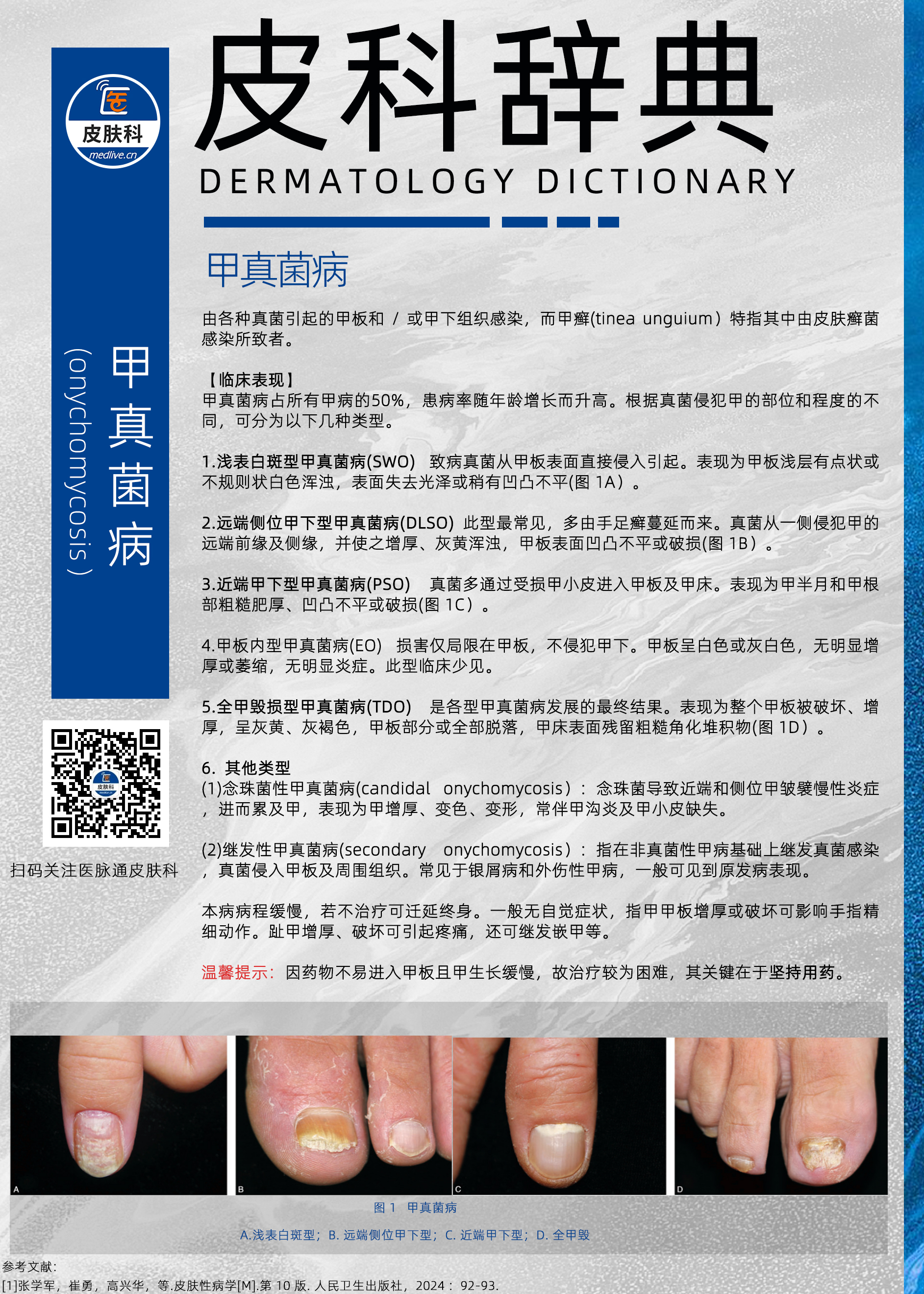 【皮科辞典第25期】甲真菌病.jpg