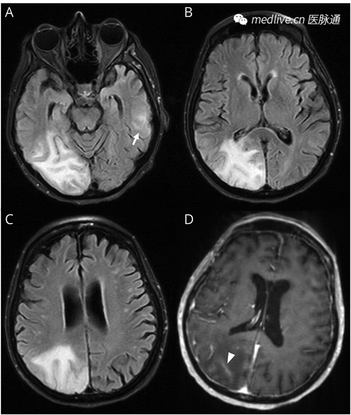 1742207993793286.png 微信图片_20250317183917.png