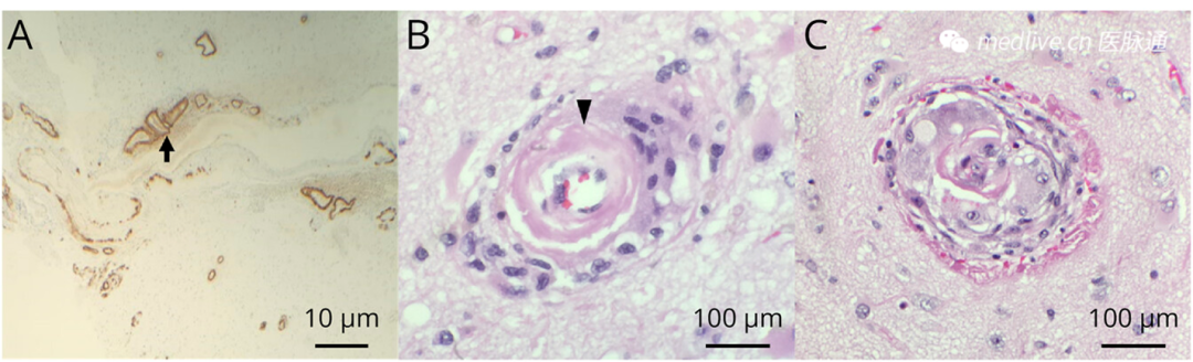 1742208017137787.png 微信图片_20250317183921.png