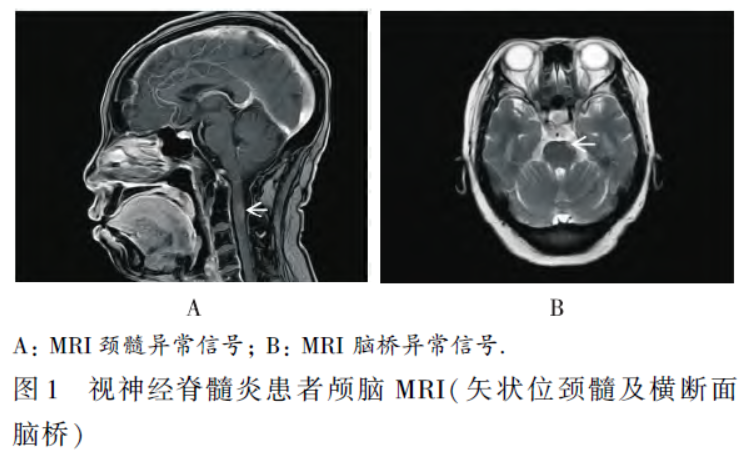 1742461479394586.png 1742461479394586.png