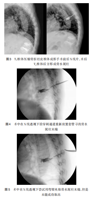 图3.png