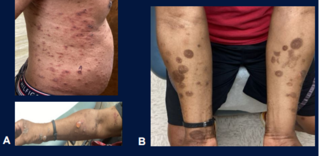 1743129457992278.png 640 (1).png