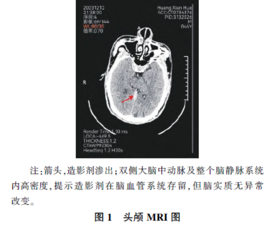 1743409220735396.png 屏幕截图 2025-03-31 162038.png