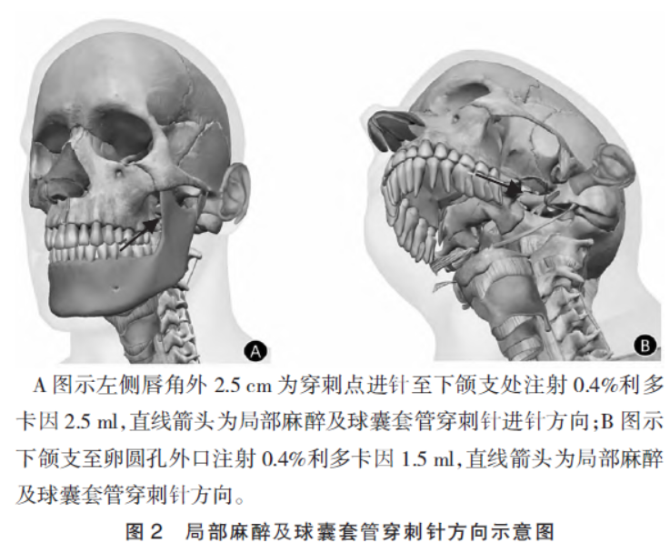 1743471638306721.png