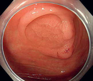 1744355382693011.png 图1.png