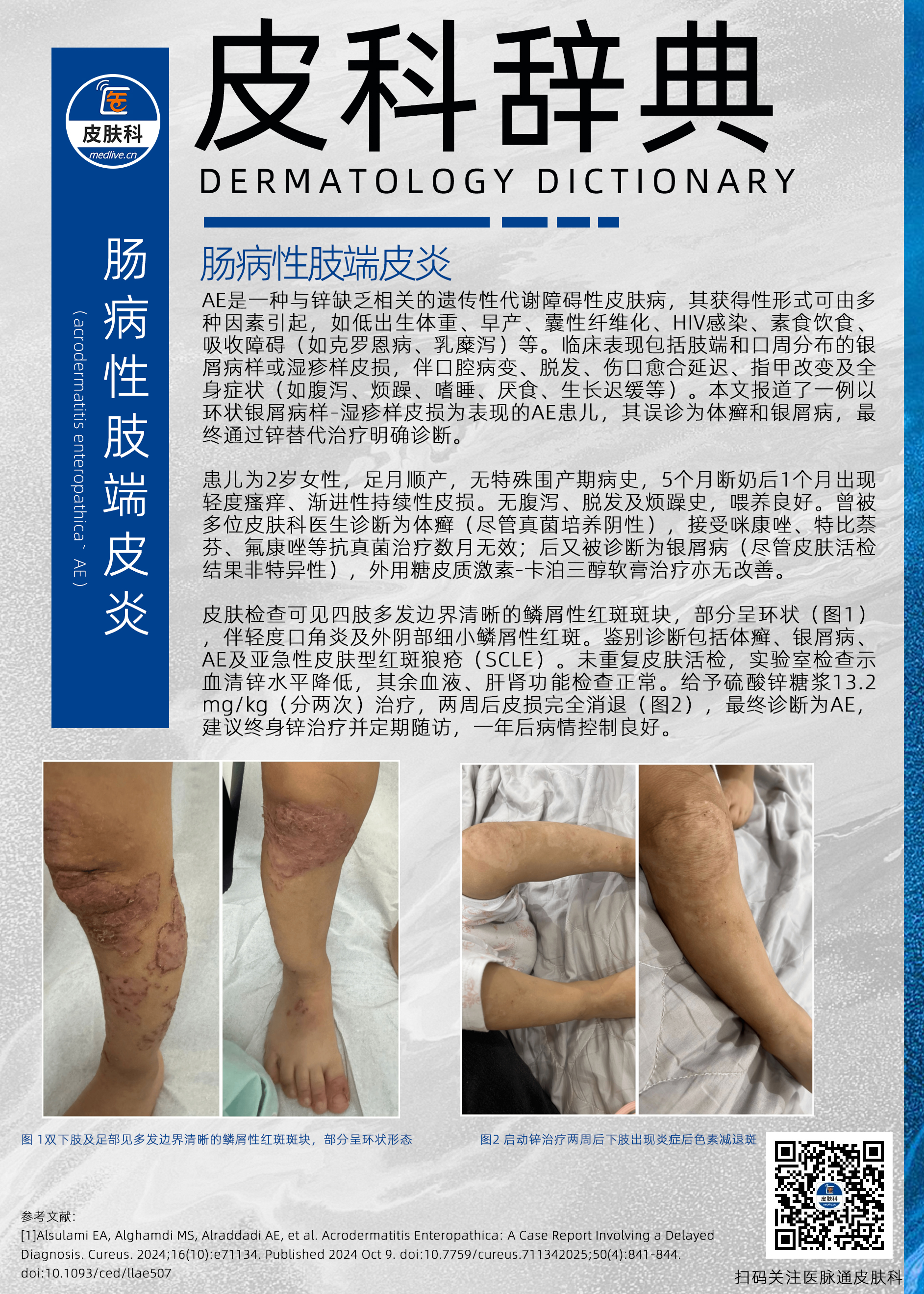 1747991950801358.jpg 皮科辞典53期AE.jpg