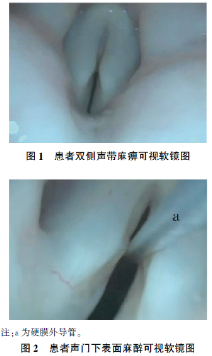 1749117236264138.png 屏幕截图 2025-06-05 175325.png