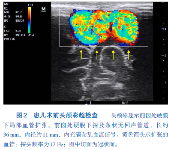 1749171925828889.png 2.png