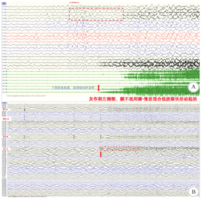 1749179512995110.png 1749179512995110.png