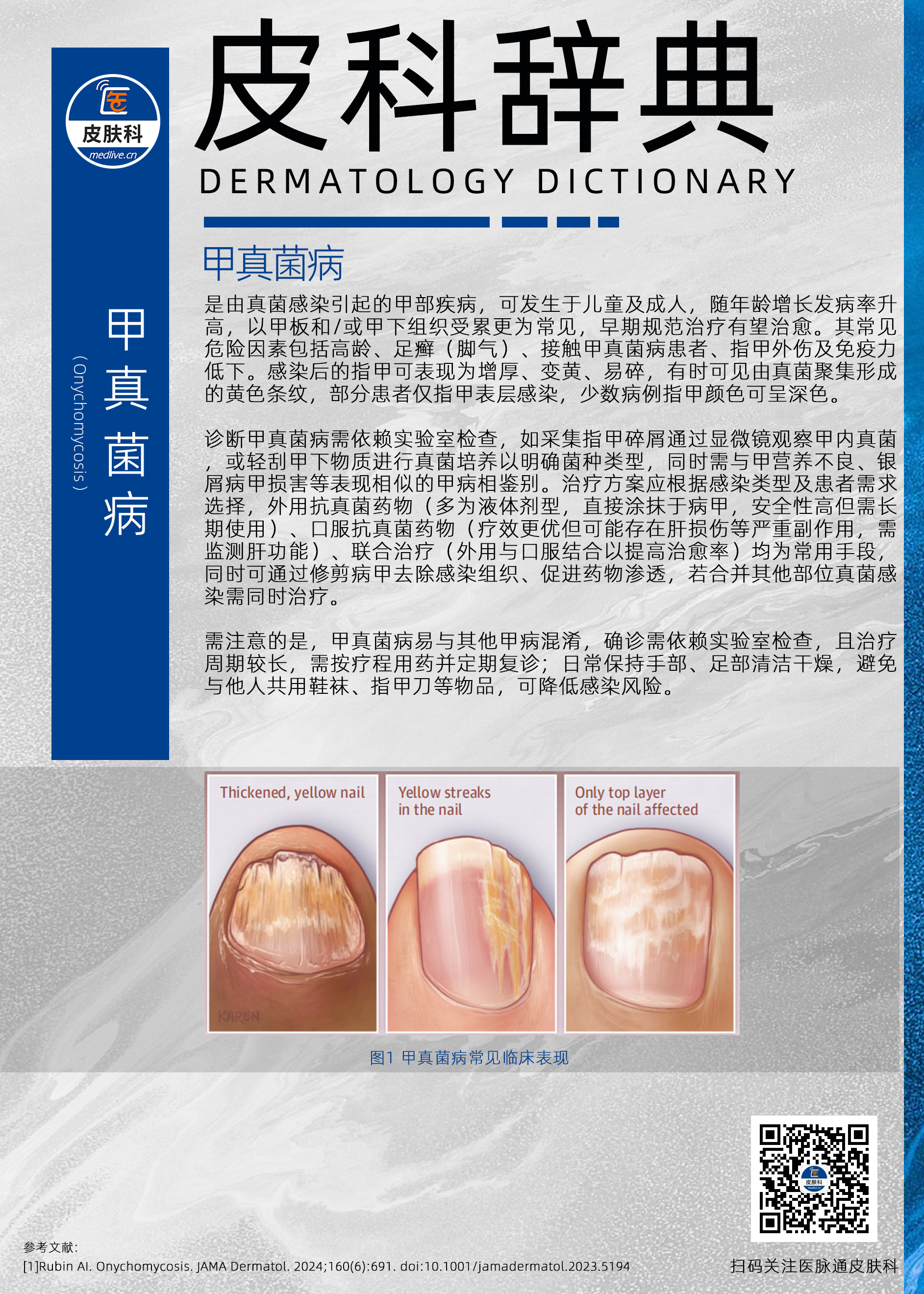 58甲真菌病】.jpg