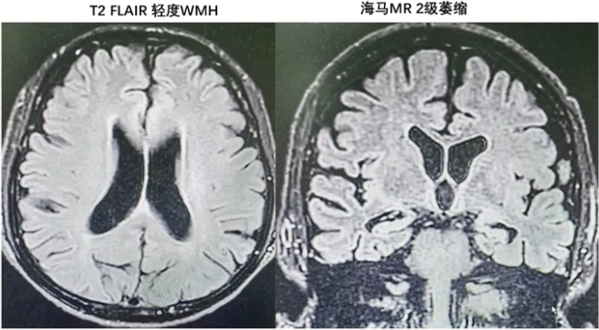 1749195506408858.png 微信图片_20250606153813.png