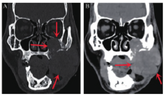 1751874223166035.png 3.png