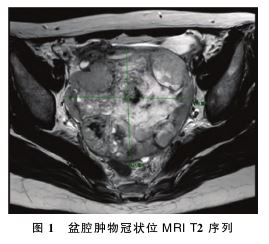 1753062339757734.jpg 1753062339757734.jpg