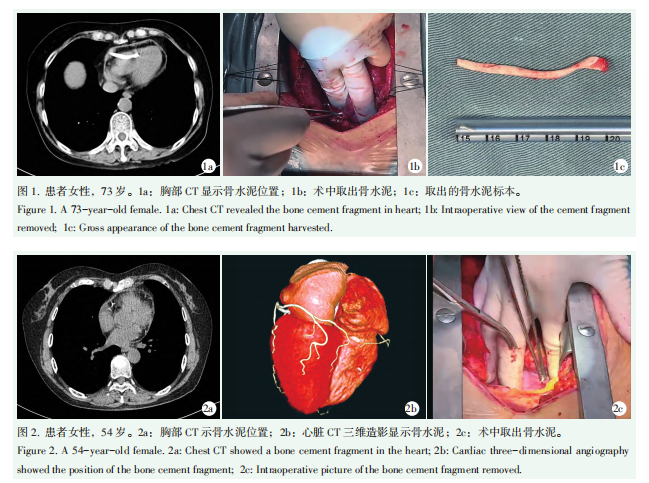 1754444953268333.png 图1.png