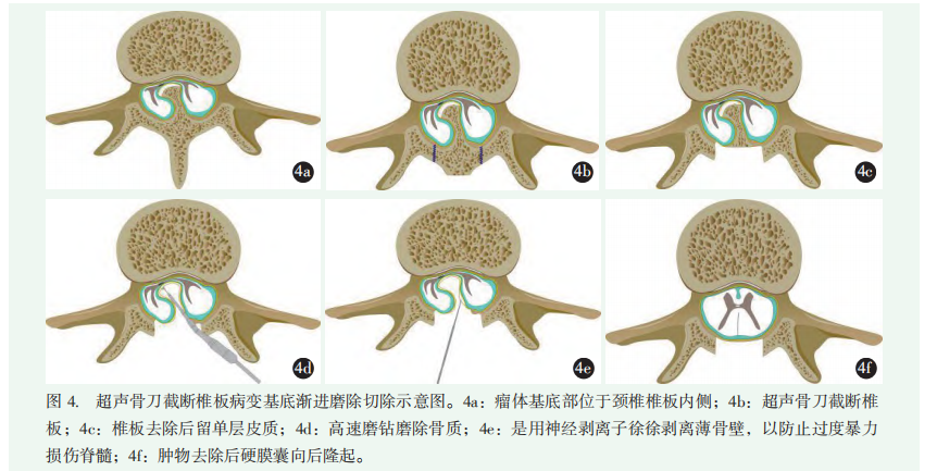 图4.png