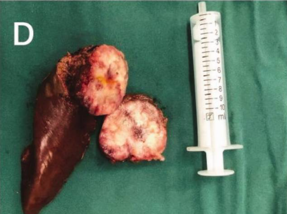 1756255219715660.png DM_20250827083125_004.png