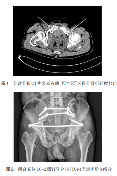 1756430169969401.png 图1.png