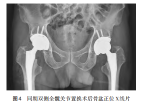 图4.png