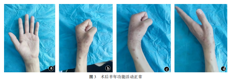 图3.png
