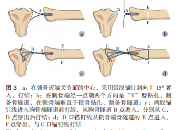 图3.png