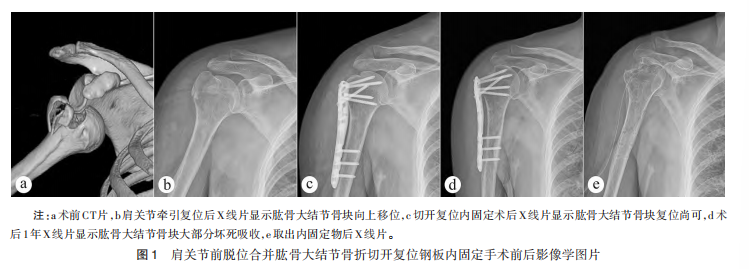 图1.png