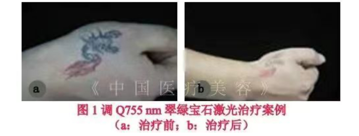 1760422242542031.jpg 1760422242542031.jpg