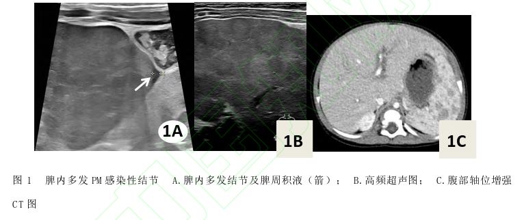 1760925262137554.jpg 1760925262137554.jpg