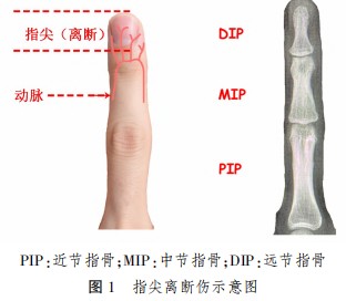 1761025407254588.png 图1.png