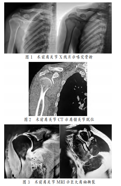 1761988883121585.png 图1.png