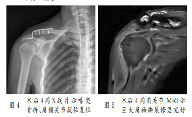 1761988897780149.png 图4.png